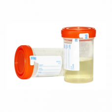 Urine Specimen Bottle with Lid